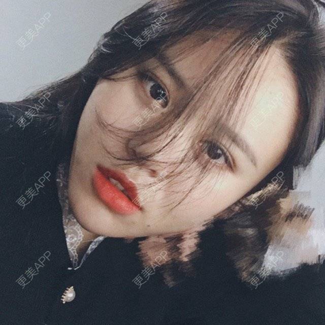 更美 - xin💕的经验 | 膨体隆鼻 | 郑州