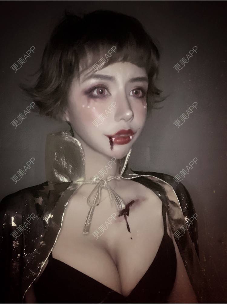 更美 - 上个世纪祖国的花朵的自体脂肪全面部填充经验 | 视频日记 | 自体脂肪隆胸 | 自体脂肪全面部填充 | 自体脂肪填充面部细纹 | 自体脂肪丰臀 | 北京