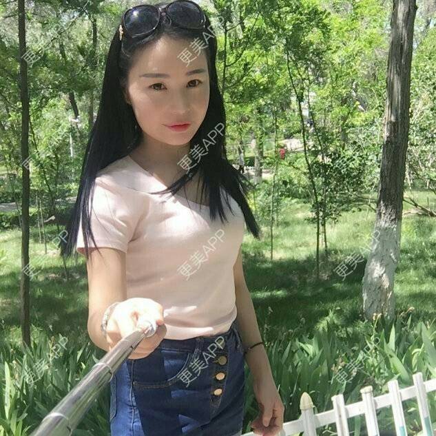 更美 - 爱美的尼雅的除皱瘦脸经验 | 除皱瘦脸 | 邯郸