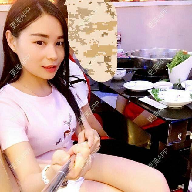 更美 - 爱美的尼雅的除皱瘦脸经验 | 除皱瘦脸 | 邯郸
