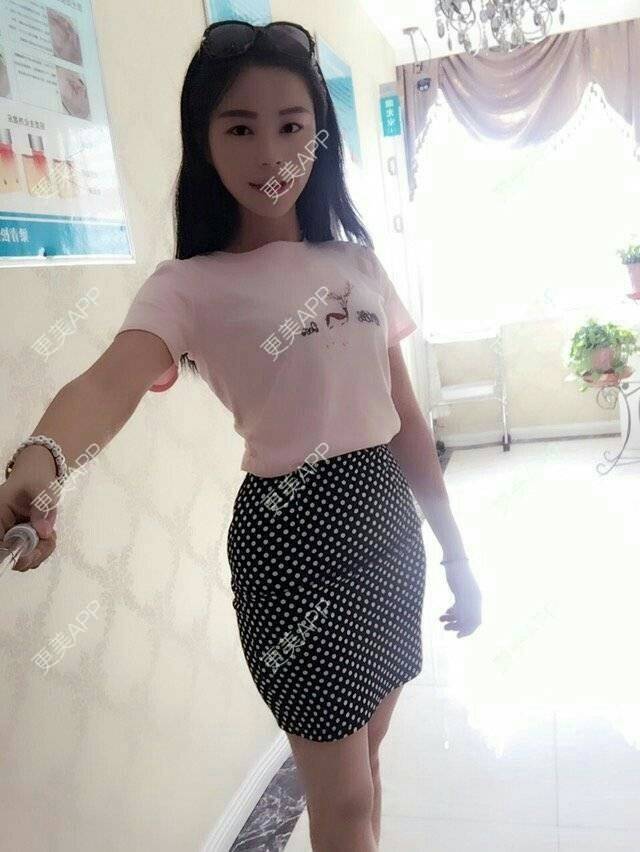 更美 - 爱美的尼雅的除皱瘦脸经验 | 除皱瘦脸 | 邯郸