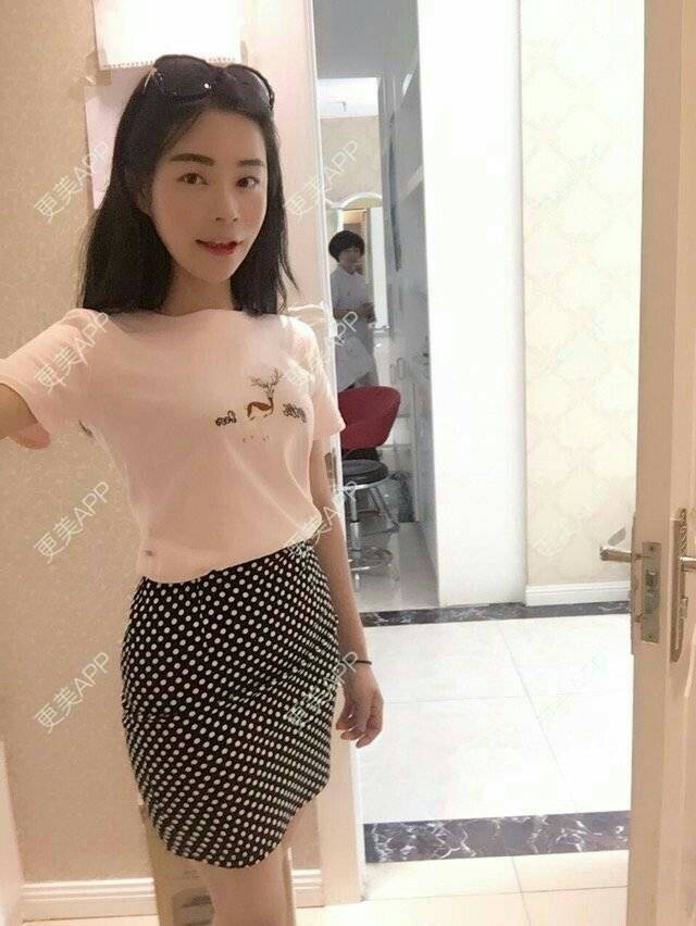 更美 - 爱美的尼雅的除皱瘦脸经验 | 除皱瘦脸 | 邯郸