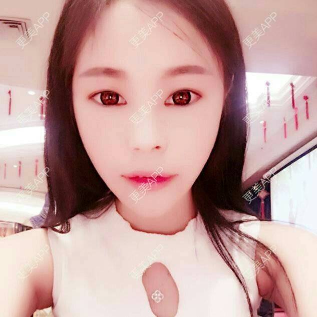 更美 - 爱美的尼雅的除皱瘦脸经验 | 除皱瘦脸 | 邯郸