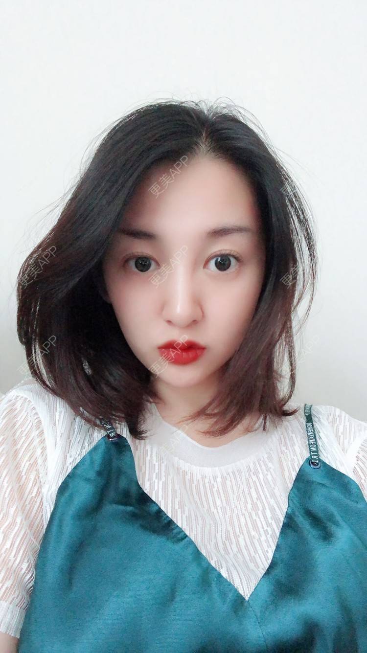 更美 - 更美用户COi6YHbVqT的宽下巴矫正经验 | 宽下巴矫正