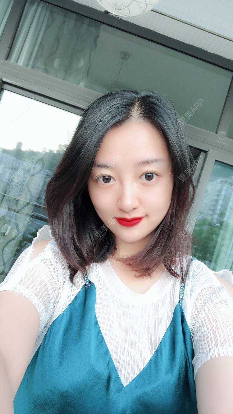 更美 - 更美用户COi6YHbVqT的宽下巴矫正经验 | 宽下巴矫正