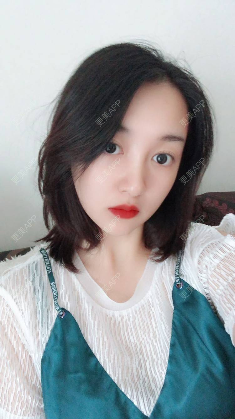更美 - 更美用户COi6YHbVqT的宽下巴矫正经验 | 宽下巴矫正