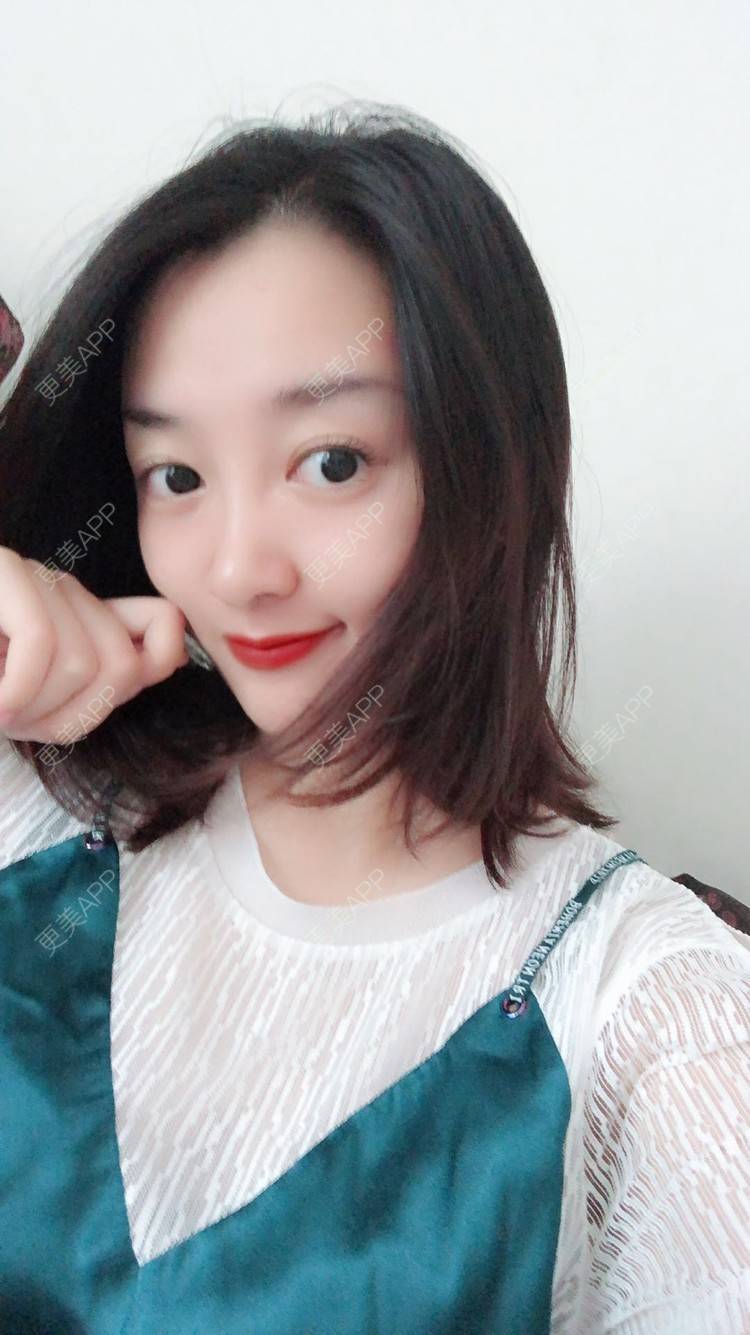 更美 - 更美用户COi6YHbVqT的宽下巴矫正经验 | 宽下巴矫正