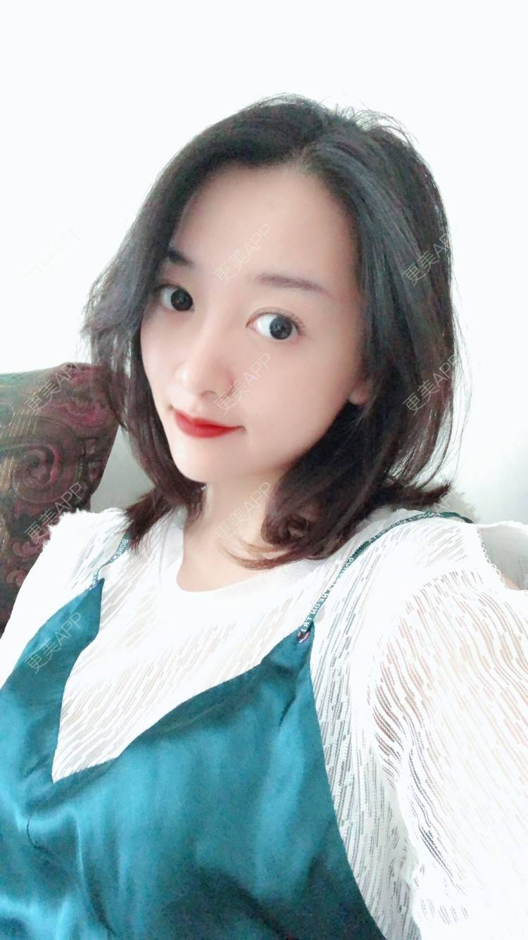 更美 - 更美用户COi6YHbVqT的宽下巴矫正经验 | 宽下巴矫正