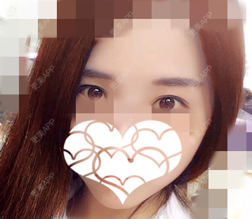 更美 - 更美用户v1Koe40Vxb的半永久纹眼线经验 | 北京 | 半永久纹眼线