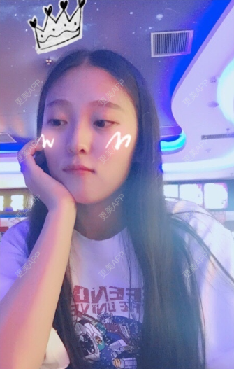 更美 - 于太阳的玻尿酸黑眼圈经验 | 玻尿酸黑眼圈