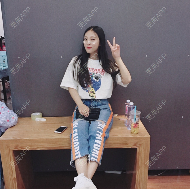 更美 - 于太阳的玻尿酸黑眼圈经验 | 玻尿酸黑眼圈