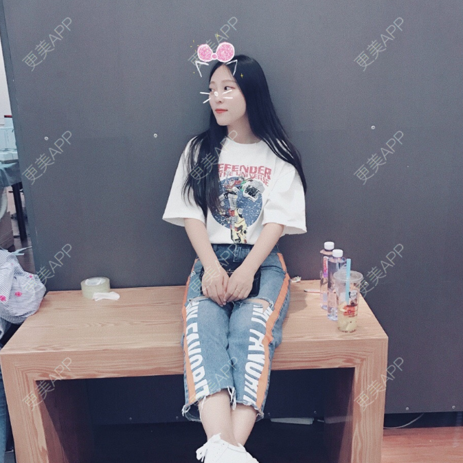 更美 - 于太阳的玻尿酸黑眼圈经验 | 玻尿酸黑眼圈