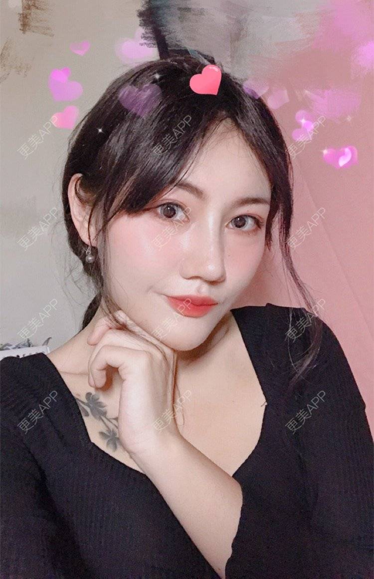 更美 - Kaleidoscope.的隆鼻经验 | 咸阳 | 隆鼻