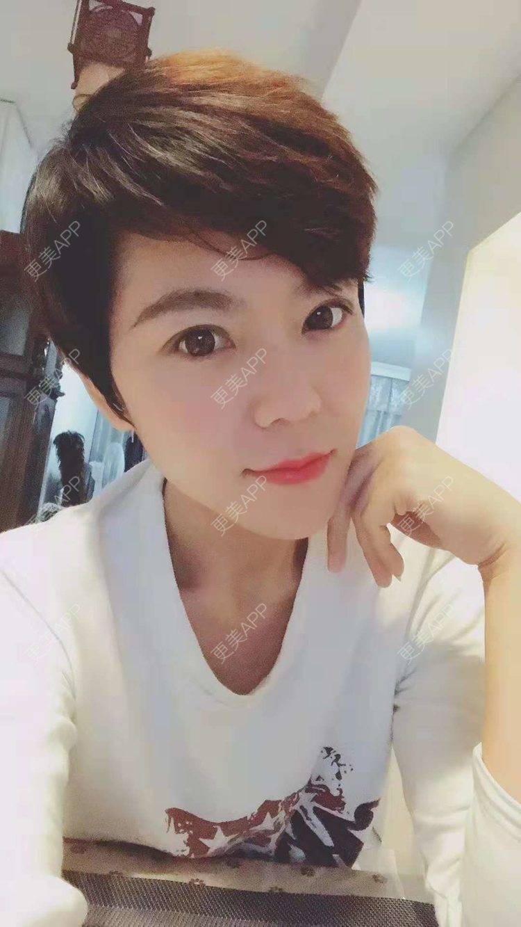更美 - 鞍山铁东区张玉霞星范医疗美容门诊部的埋线隆鼻经验 | 埋线隆鼻