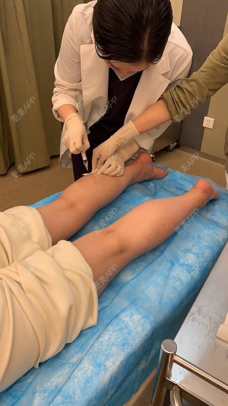 更美用户gd2hr8urxs的除皱瘦脸瘦腿日记