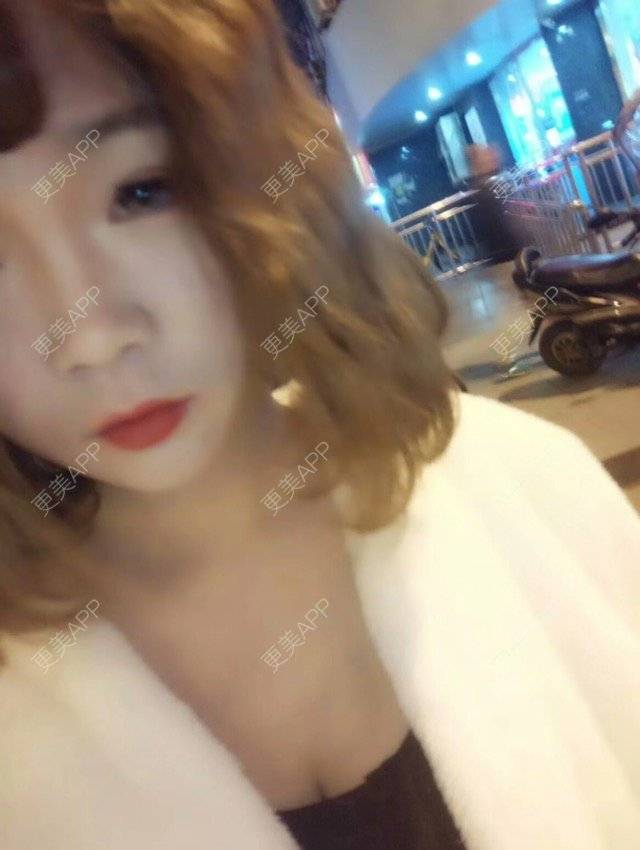 更美 - 嘻嘻图二八的乳晕缩小经验 | 乳晕缩小 | 胸部塑身