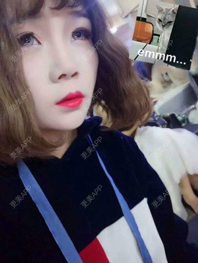 更美 - 嘻嘻图二八的乳晕缩小经验 | 乳晕缩小 | 胸部塑身