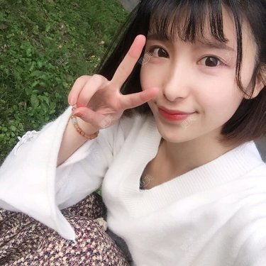 玻尿酸鼻部