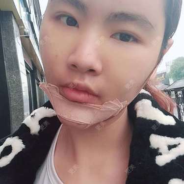 （摩天大楼）