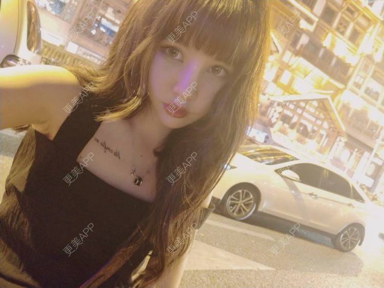 更美 - 龙喵ɑ^0^的膨体垫下巴经验 | 南宁 | 膨体垫下巴