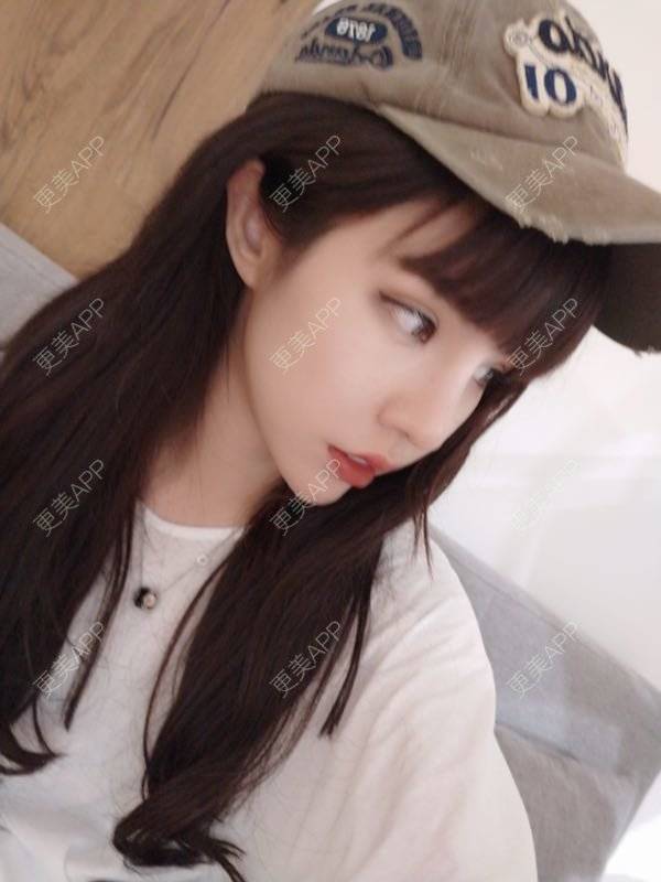 更美 - 龙喵ɑ^0^的膨体垫下巴经验 | 南宁 | 膨体垫下巴