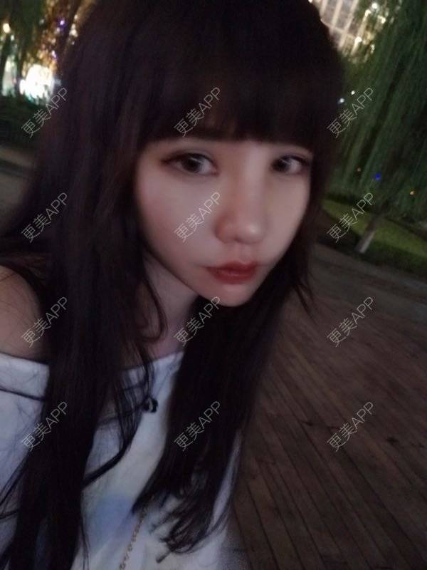 更美 - 龙喵ɑ^0^的膨体垫下巴经验 | 南宁 | 膨体垫下巴