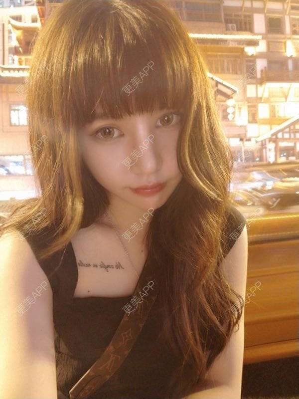 更美 - 龙喵ɑ^0^的膨体垫下巴经验 | 南宁 | 膨体垫下巴