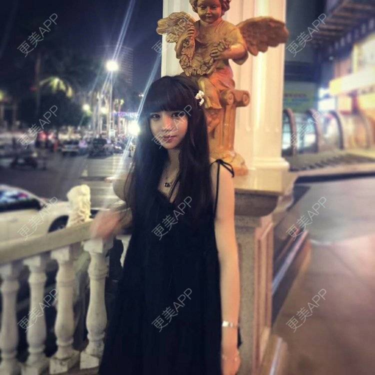 更美 - 龙喵ɑ^0^的膨体垫下巴经验 | 南宁 | 膨体垫下巴