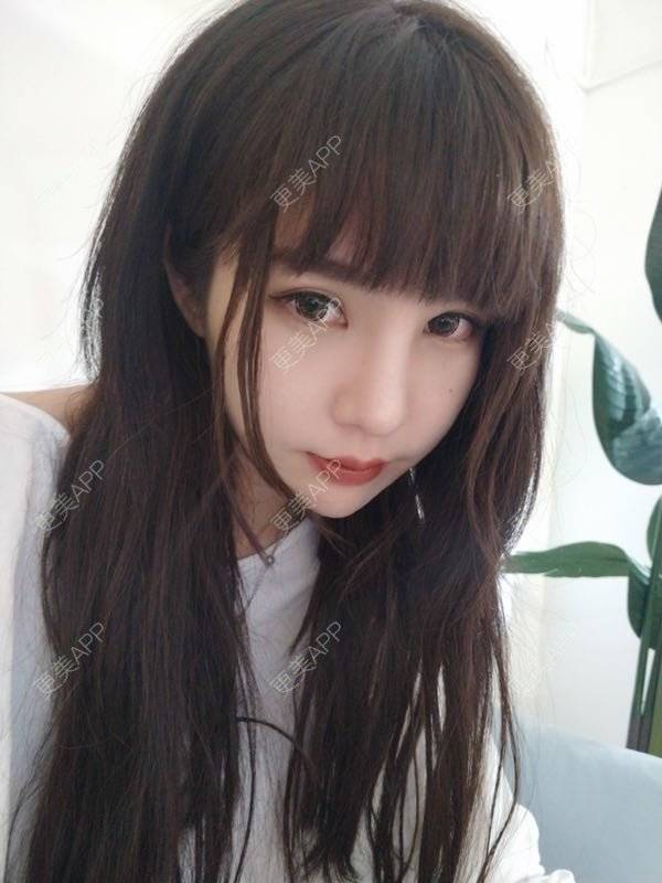 更美 - 龙喵ɑ^0^的膨体垫下巴经验 | 南宁 | 膨体垫下巴