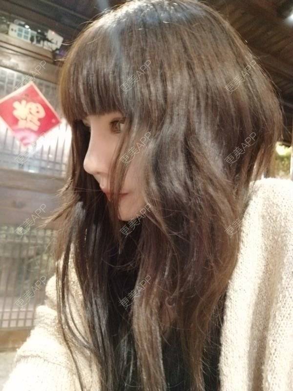 更美 - 龙喵ɑ^0^的膨体垫下巴经验 | 南宁 | 膨体垫下巴