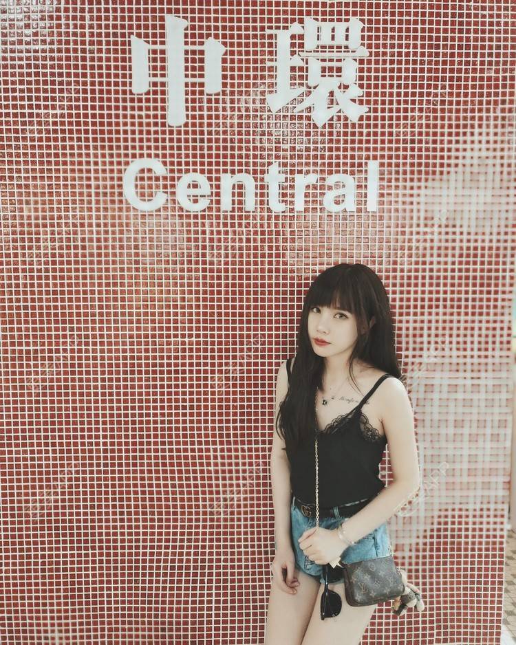 更美 - 龙喵ɑ^0^的膨体垫下巴经验 | 南宁 | 膨体垫下巴