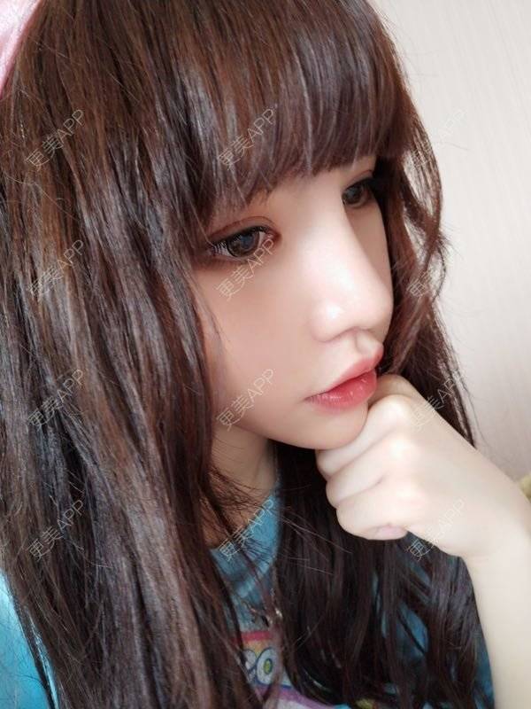 更美 - 龙喵ɑ^0^的膨体垫下巴经验 | 南宁 | 膨体垫下巴