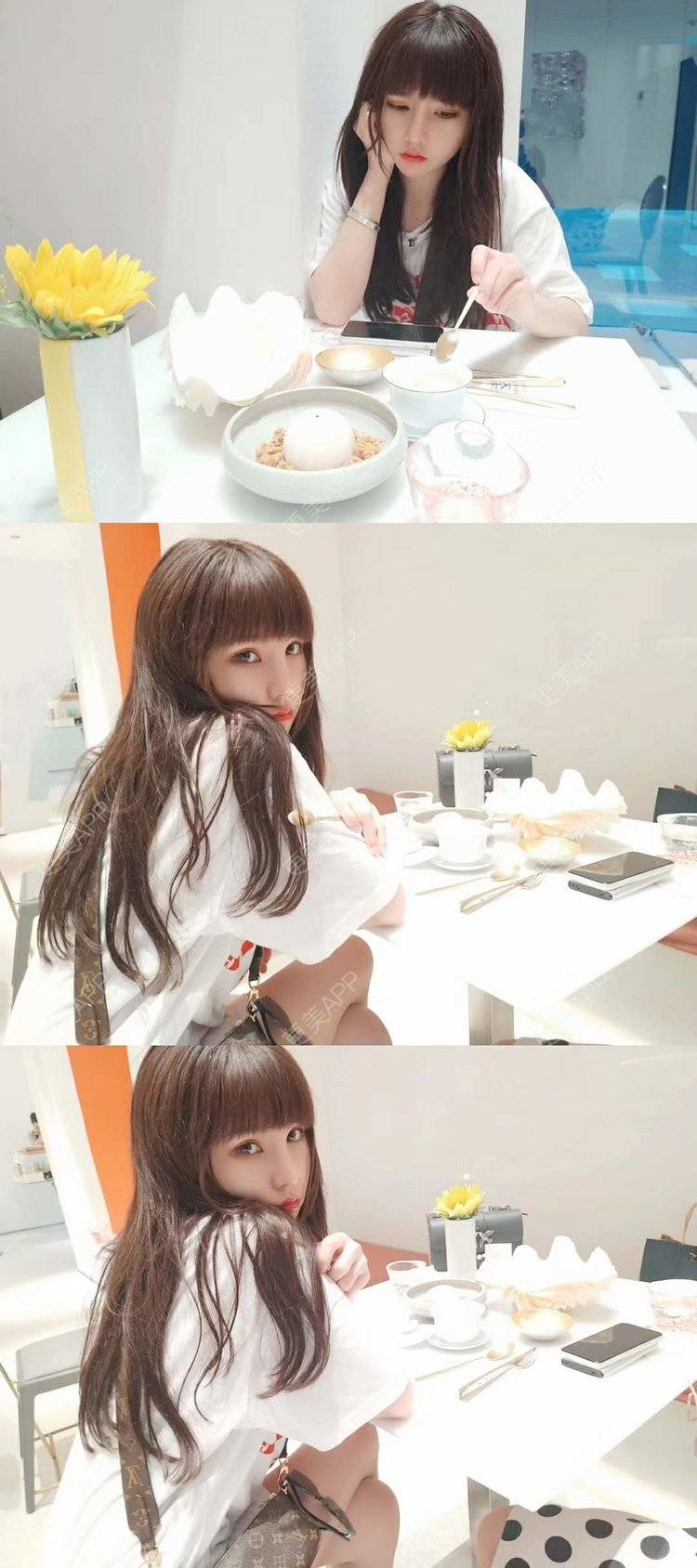 更美 - 龙喵ɑ^0^的膨体垫下巴经验 | 南宁 | 膨体垫下巴