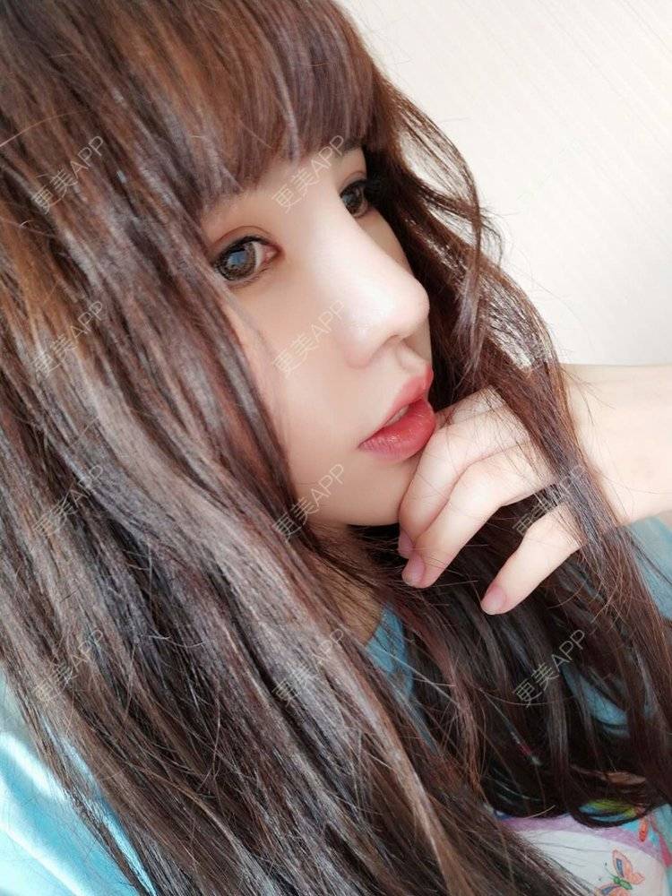 更美 - 龙喵ɑ^0^的膨体垫下巴经验 | 南宁 | 膨体垫下巴