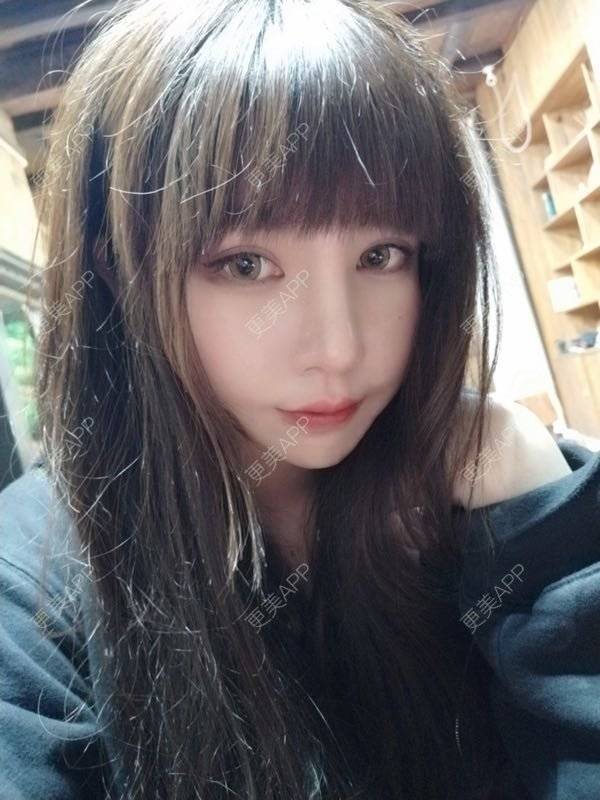 更美 - 龙喵ɑ^0^的膨体垫下巴经验 | 南宁 | 膨体垫下巴