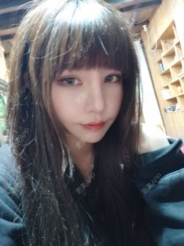 更美 - 龙喵ɑ^0^的膨体垫下巴经验 | 南宁 | 膨体垫下巴