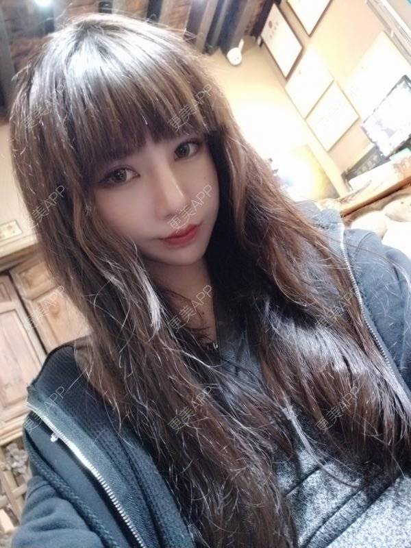 更美 - 龙喵ɑ^0^的膨体垫下巴经验 | 南宁 | 膨体垫下巴