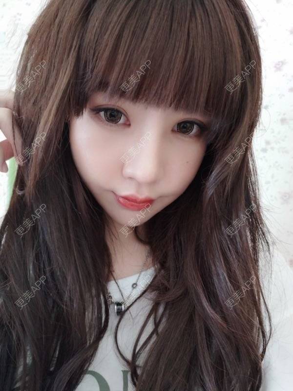 更美 - 龙喵ɑ^0^的膨体垫下巴经验 | 南宁 | 膨体垫下巴