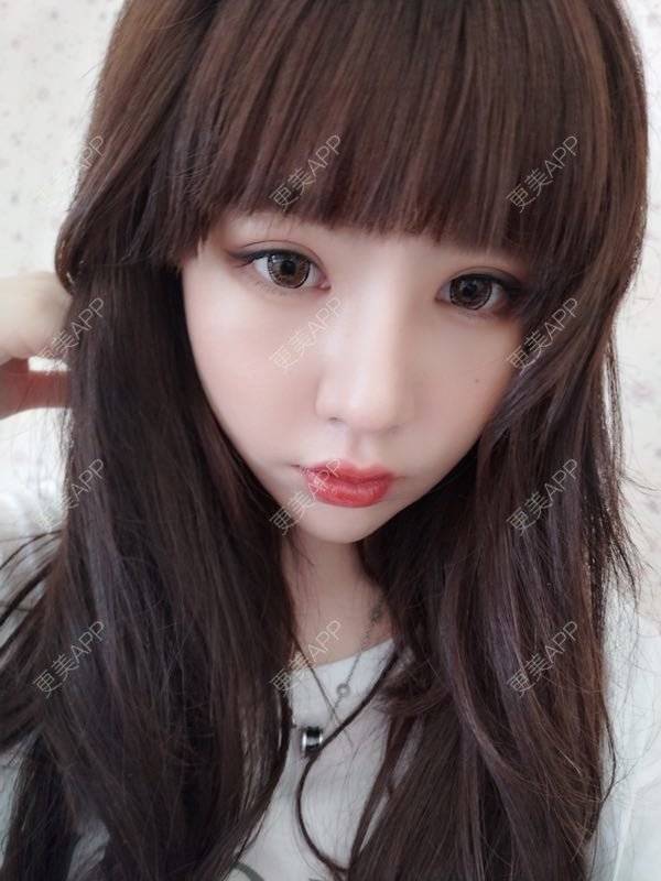 更美 - 龙喵ɑ^0^的膨体垫下巴经验 | 南宁 | 膨体垫下巴