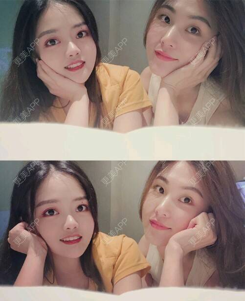 更美 - 好可可的冷光美白经验 | 成都 | 冷光美白