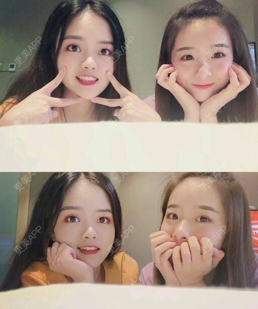 更美 - 好可可的冷光美白经验 | 成都 | 冷光美白