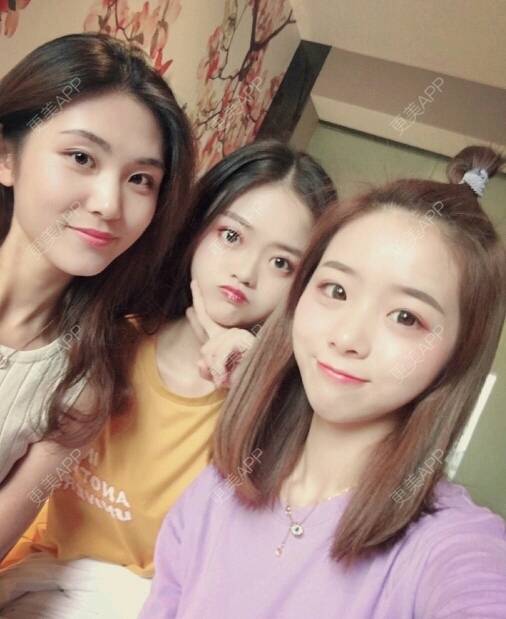 更美 - 好可可的冷光美白经验 | 成都 | 冷光美白