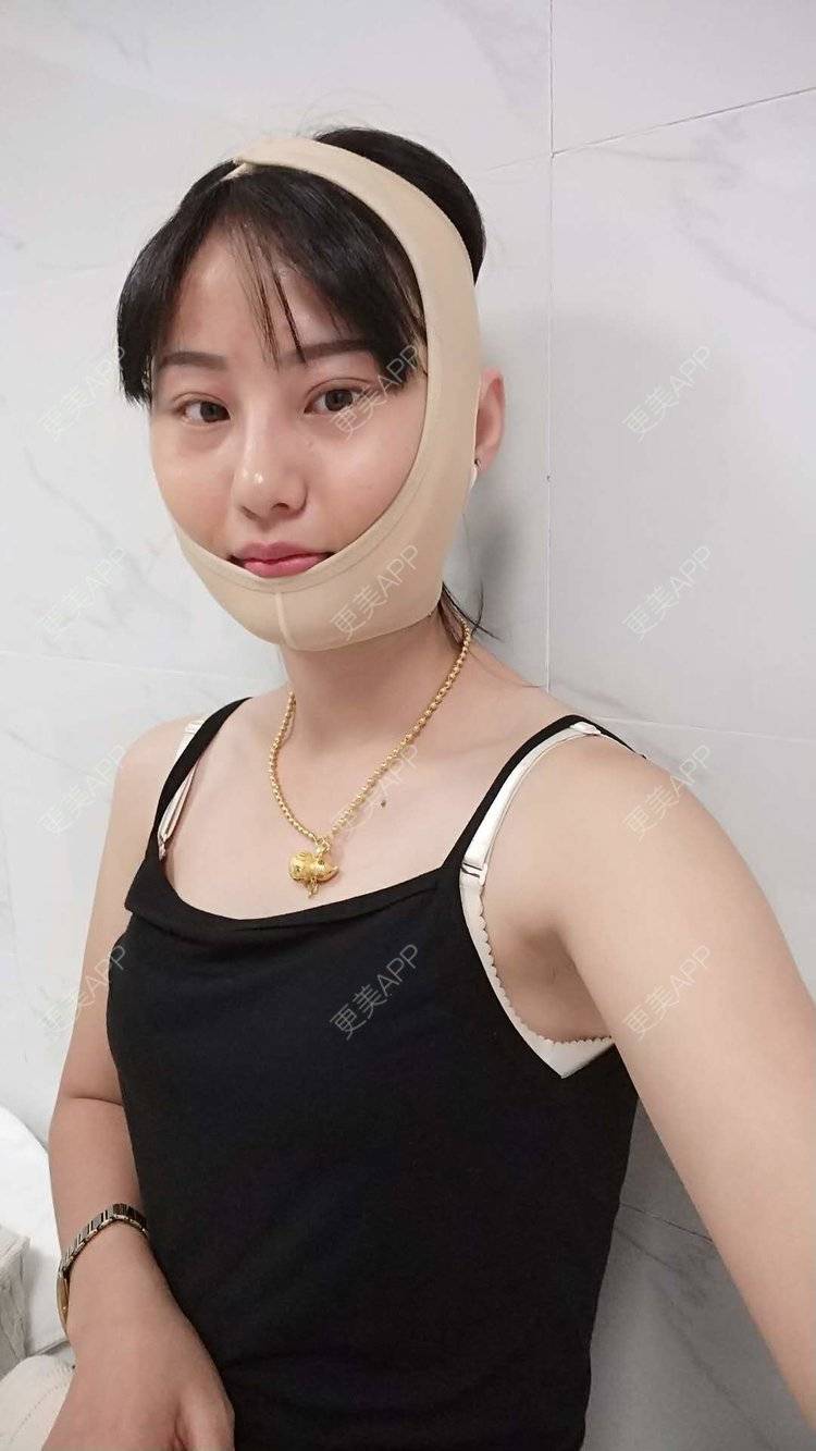 清香雨荷的光纤溶脂日记