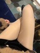 更美 - 请叫我小花的吸脂瘦大腿经验 | 吸脂瘦大腿 | 北京