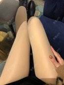 更美 - 请叫我小花的吸脂瘦大腿经验 | 吸脂瘦大腿 | 北京