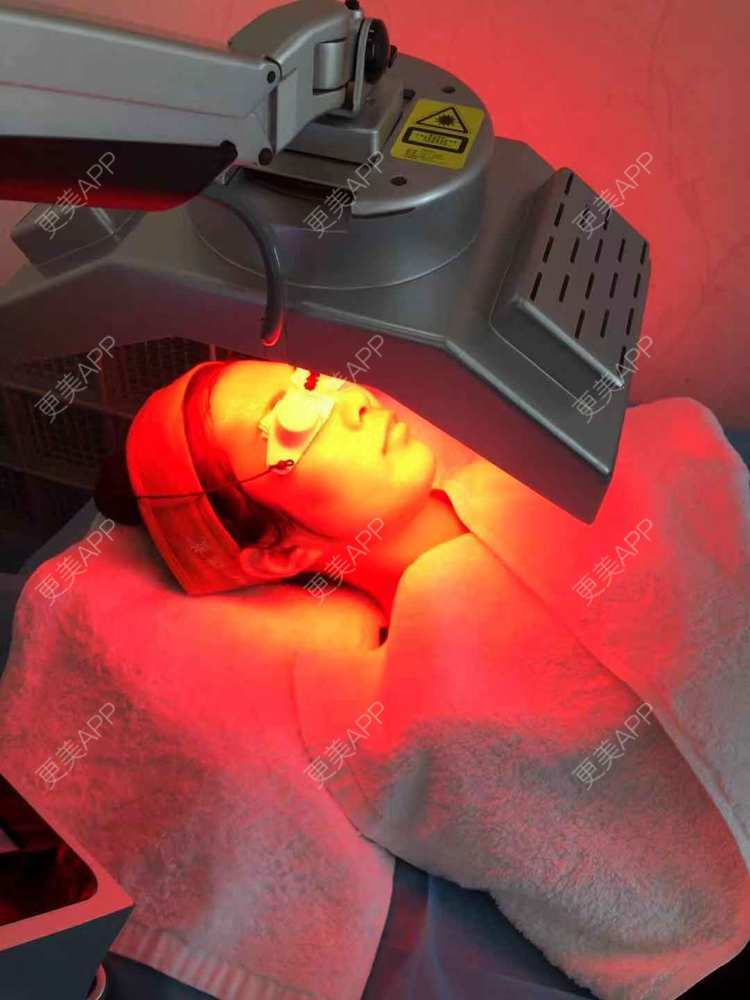 斑马小金的镭射净肤日记