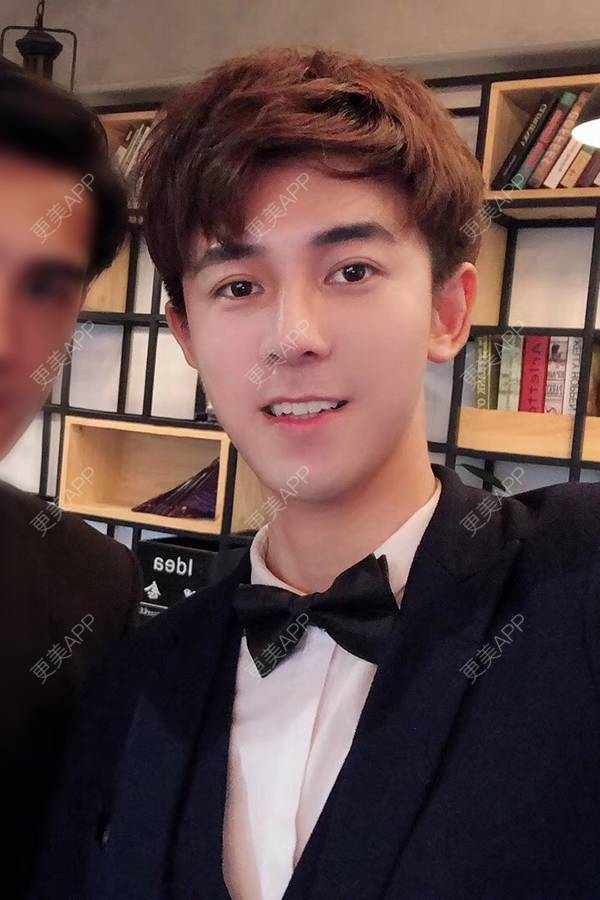 更美 - 唐航 医生的隆鼻经验 | 深圳 | 隆鼻