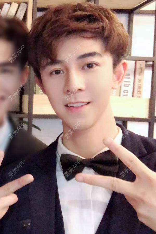 更美 - 唐航 医生的隆鼻经验 | 深圳 | 隆鼻