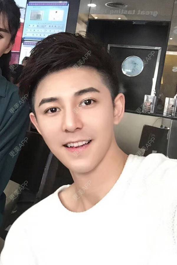 更美 - 唐航 医生的隆鼻经验 | 深圳 | 隆鼻