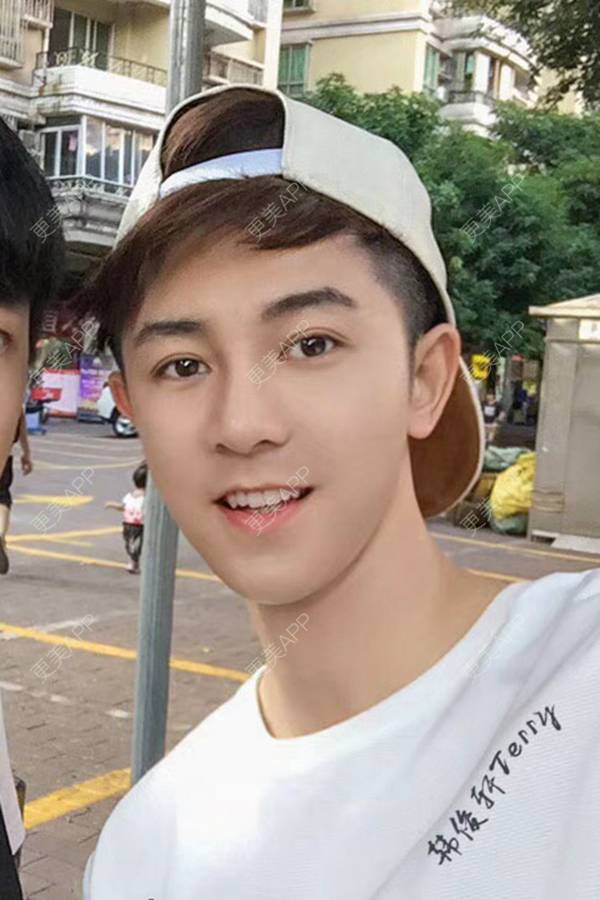 更美 - 唐航 医生的隆鼻经验 | 深圳 | 隆鼻